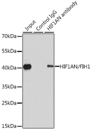 Anti-HIF1AN antibody used in Immunoprecipitation (IP). GTX32652