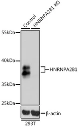 Anti-hnRNP A2B1 antibody used in Western Blot (WB). GTX32657