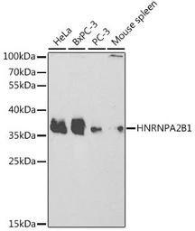 Anti-hnRNP A2B1 antibody used in Western Blot (WB). GTX32657