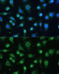 Anti-hnRNP A0 antibody used in Immunocytochemistry/ Immunofluorescence (ICC/IF). GTX32659
