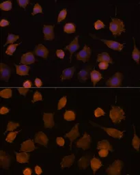 Anti-ICAM1 / CD54 antibody used in Immunocytochemistry/ Immunofluorescence (ICC/IF). GTX32663