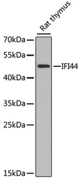 Anti-IFI44 antibody used in Western Blot (WB). GTX32667