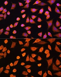 Anti-IL17A antibody used in Immunocytochemistry/ Immunofluorescence (ICC/IF). GTX32674