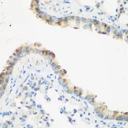 Anti-IMP3 antibody used in IHC (Paraffin sections) (IHC-P). GTX32680
