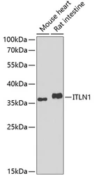 Anti-ITLN1 antibody used in Western Blot (WB). GTX32687