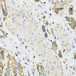Anti-LAMP2 antibody used in IHC (Paraffin sections) (IHC-P). GTX32699