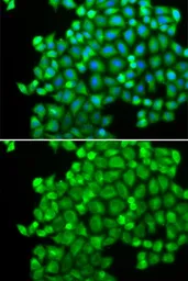 Anti-LDHA antibody used in Immunocytochemistry/ Immunofluorescence (ICC/IF). GTX32701