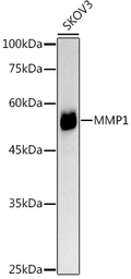 Anti-MMP1 antibody used in Western Blot (WB). GTX32723