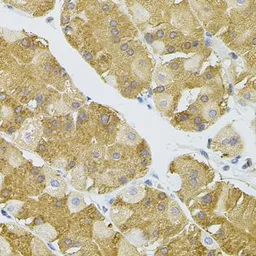 Anti-NAT8 antibody used in IHC (Paraffin sections) (IHC-P). GTX32737