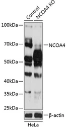 Anti-NCOA4 antibody used in Western Blot (WB). GTX32739
