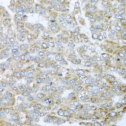 Anti-NDUFA2 antibody used in IHC (Paraffin sections) (IHC-P). GTX32741