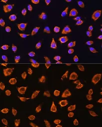 Anti-NOTCH4 antibody used in Immunocytochemistry/ Immunofluorescence (ICC/IF). GTX32755