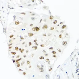 Anti-Nuclear Matrix Protein p84 antibody used in IHC (Paraffin sections) (IHC-P). GTX32757