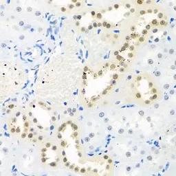 Anti-Nuclear Matrix Protein p84 antibody used in IHC (Paraffin sections) (IHC-P). GTX32757