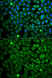 Anti-Nucleoporin p62 antibody used in Immunocytochemistry/ Immunofluorescence (ICC/IF). GTX32758