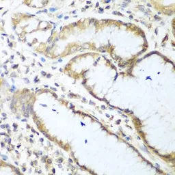 Anti-NUDT15 antibody used in IHC (Paraffin sections) (IHC-P). GTX32759