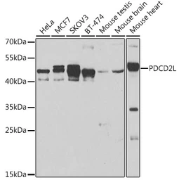 Anti-PDCD2L antibody used in Western Blot (WB). GTX32776