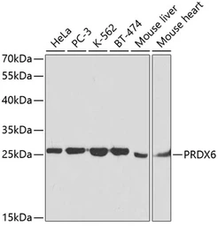 Anti-Peroxiredoxin 6 antibody used in Western Blot (WB). GTX32779