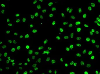 Anti-PHF19 antibody used in Immunocytochemistry/ Immunofluorescence (ICC/IF). GTX32787
