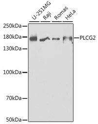 Anti-PLCG2 antibody used in Western Blot (WB). GTX32793