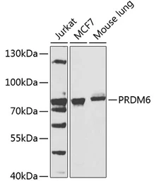 Anti-PRDM6 antibody used in Western Blot (WB). GTX32807