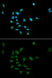 Anti-Proteasome 20S alpha 1 antibody used in Immunocytochemistry/ Immunofluorescence (ICC/IF). GTX32814