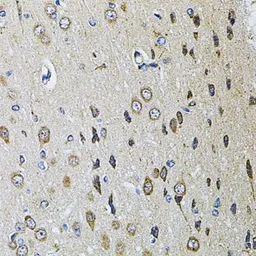 Anti-PTPRE antibody used in IHC (Paraffin sections) (IHC-P). GTX32824