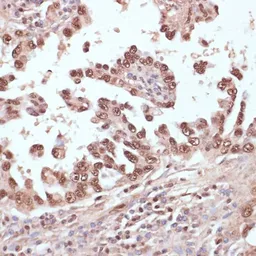 Anti-Rad50 antibody used in IHC (Paraffin sections) (IHC-P). GTX32832