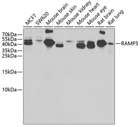 Anti-RAMP3 antibody used in Western Blot (WB). GTX32833