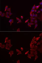 Anti-RAMP3 antibody used in Immunocytochemistry/ Immunofluorescence (ICC/IF). GTX32833