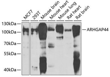 Anti-RICH2 antibody used in Western Blot (WB). GTX32841