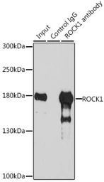 Anti-ROCK1 antibody used in Immunoprecipitation (IP). GTX32843