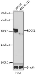 Anti-ROCK1 antibody used in Western Blot (WB). GTX32843