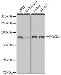 Anti-ROCK1 antibody used in Western Blot (WB). GTX32843