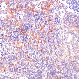 Anti-ROCK1 antibody used in IHC (Paraffin sections) (IHC-P). GTX32843