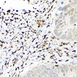 Anti-S100A4 antibody used in IHC (Paraffin sections) (IHC-P). GTX32855