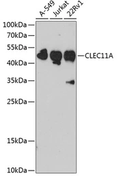 Anti-SCGF antibody used in Western Blot (WB). GTX32860