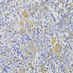 Anti-SLUG antibody used in IHC (Paraffin sections) (IHC-P). GTX32879