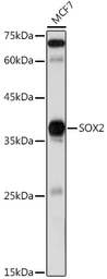 Anti-SOX2 antibody used in Western Blot (WB). GTX32891
