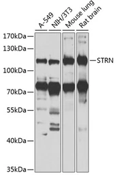 Anti-Striatin antibody used in Western Blot (WB). GTX32902