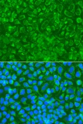 Anti-Striatin antibody used in Immunocytochemistry/ Immunofluorescence (ICC/IF). GTX32902