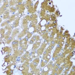 Anti-Striatin antibody used in IHC (Paraffin sections) (IHC-P). GTX32902
