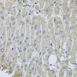 Anti-SYT11 antibody used in IHC (Paraffin sections) (IHC-P). GTX32905