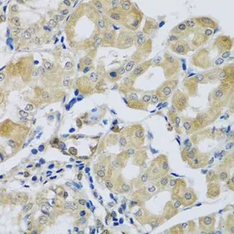 Anti-SYT11 antibody used in IHC (Paraffin sections) (IHC-P). GTX32905