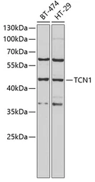 Anti-TCN1 antibody used in Western Blot (WB). GTX32915