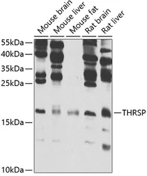 Anti-THRSP antibody used in Western Blot (WB). GTX32922