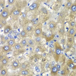 Anti-TLK2 antibody used in IHC (Paraffin sections) (IHC-P). GTX32923