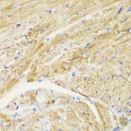 Anti-TOMM20 antibody used in IHC (Paraffin sections) (IHC-P). GTX32928