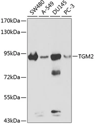 Anti-Transglutaminase 2 antibody used in Western Blot (WB). GTX32934