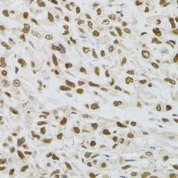 Anti-Transglutaminase 2 antibody used in IHC (Paraffin sections) (IHC-P). GTX32934